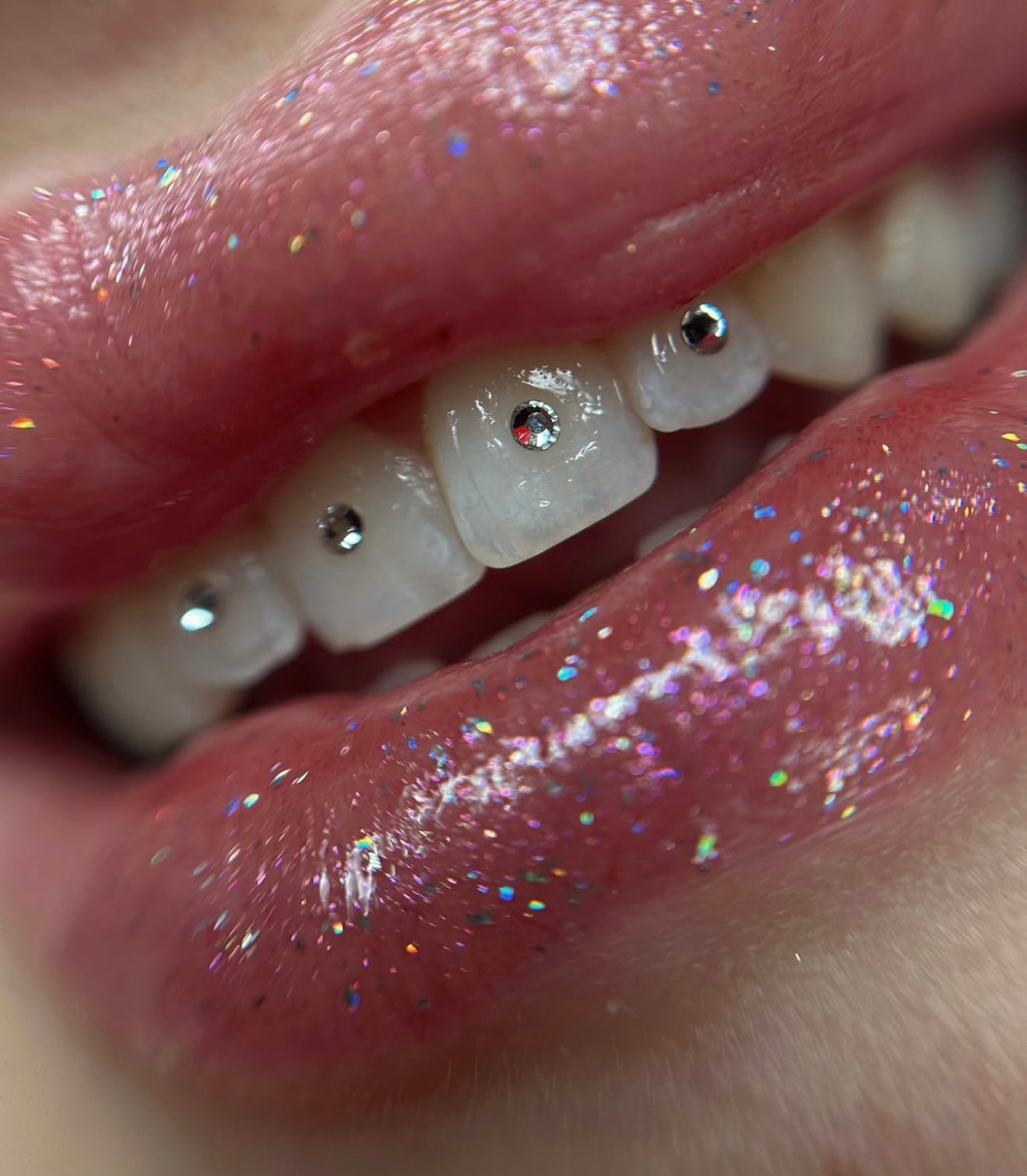 TOOTH GEM ONLINE SEMINAR